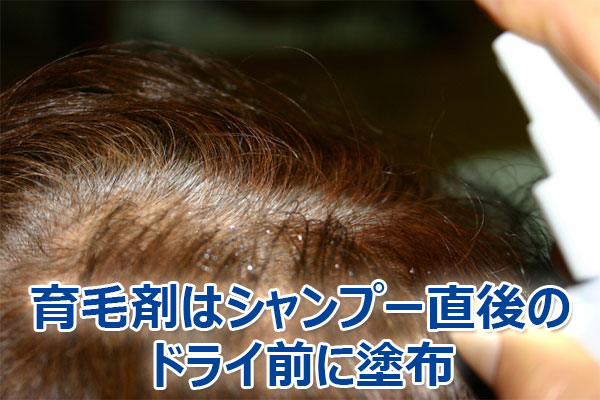 薄毛,対策,シャンプー,効果,方法,育毛