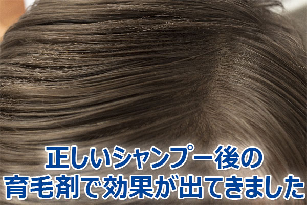 薄毛,対策,シャンプー,効果,方法,育毛